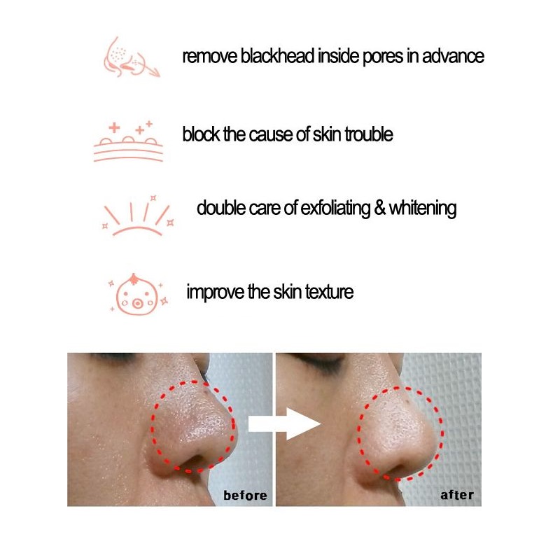 Cosrx bha blackhead power líqu - Skincare Cosrx avaliação e preço